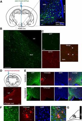 Activation of the ARCPOMC→MeA Projection Reduces Food Intake